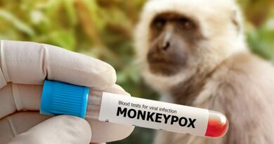 variola dos macacos Vision Art NEWS