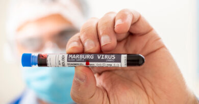 shutterstock marburg virus 2 Vision Art NEWS