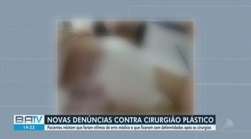 Pacientes fazem novas denuncias contra cirurgião plástico investigado por deformidades na Bahia; MP solicita informações | Bahia