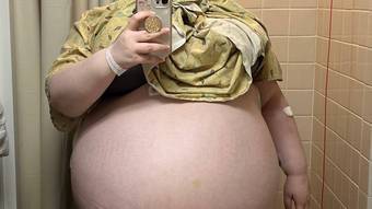 Mulher remove tumor de 47 kg no ovário: ‘A sensação era de estar grávida de dez filhos’ – Notícias
