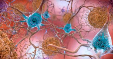 Alzheimer neuronios Vision Art NEWS