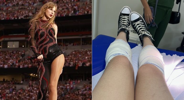Fã de Taylor Swift sofre queimadura de segundo grau em estádio por causa de estrutura metálica – Entretenimento